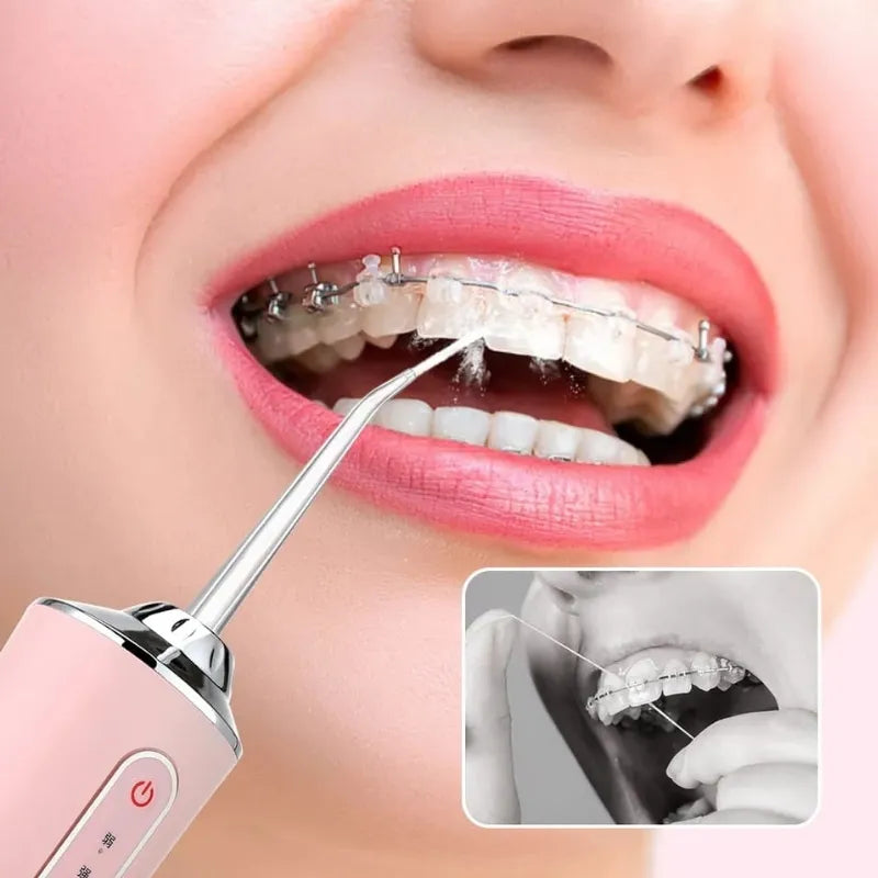 Higienizador Dental Oral Portátil Recarregável